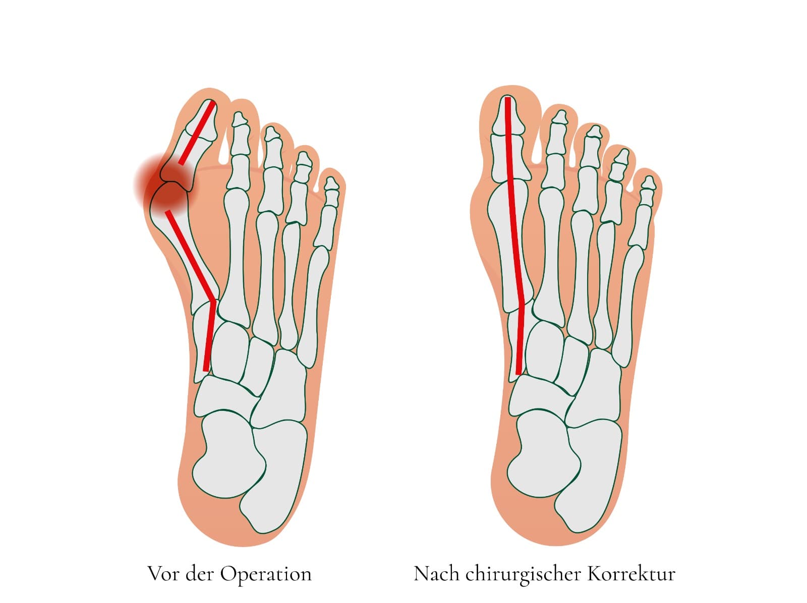 Orthofuss Orthopädische Chirurgie Zürich — Arzt in Zürich (Bild 2)