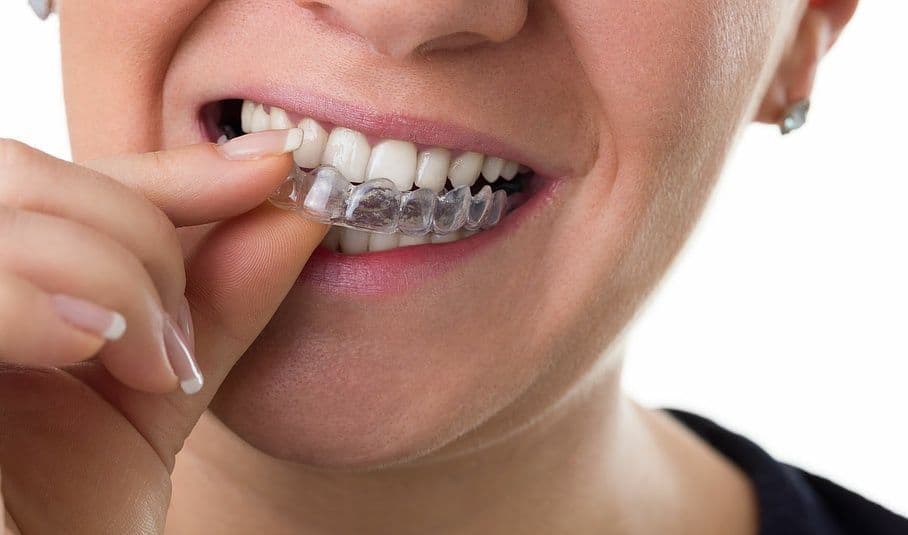 Zahnprothetik Vasi-Dental — Zahnarzt in Zürich (Bild 2)