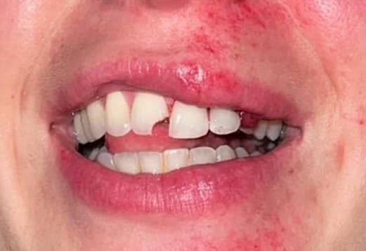Schönenberger Dentaltechnik AG — Zahnarzt in Opfikon