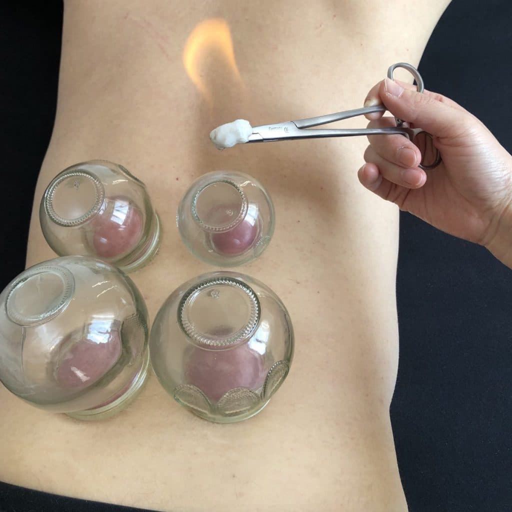 Praxis TCM Massage - Traditionelle Chinesische Medizin — Naturheilpraktiker in Zürich (Bild 3)
