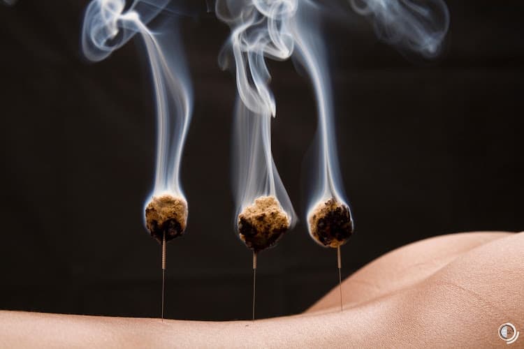 Praxis für TCM + Naturheilkunde / Sandra Dünki — Massage in Winterthur