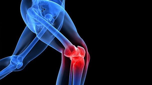 Physiotherapie Physio Töss — Massage in Winterthur (Bild 3)