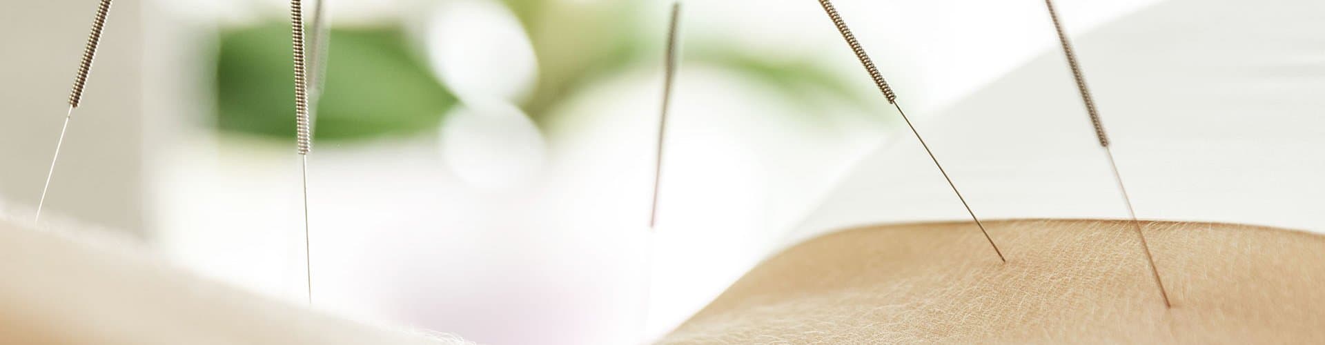 TCM Praxis für chinesische Medizin — Naturheilpraktiker in Wetzikon (Bild 3)