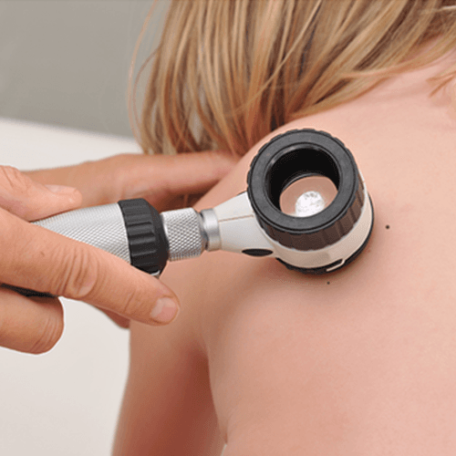Novaderm SA - Dermatologie, Hautkrebszentrum, Dermatochirurgie, Ästhetische Behandlungen und Operationen — Arzt in Affoltern am Albis (Bild 3)