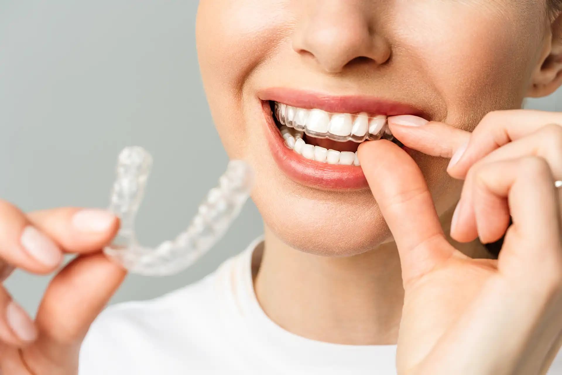 OrthoDentia Zahnmedizin Zürich — Zahnarzt in Zürich (Bild 3)