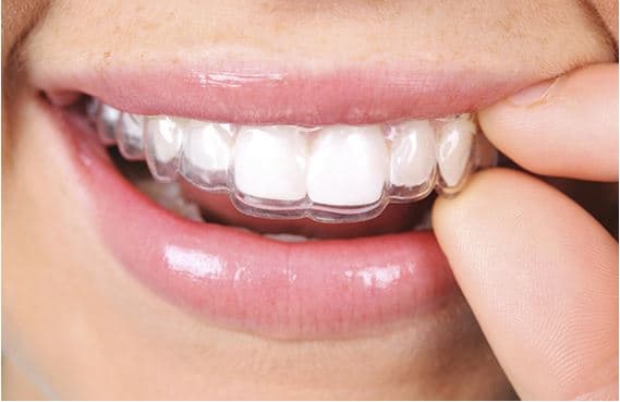 Zahnmedizin Frankental AG Dr. Marina Müller — Zahnarzt in Oberengstringen (Bild 2)