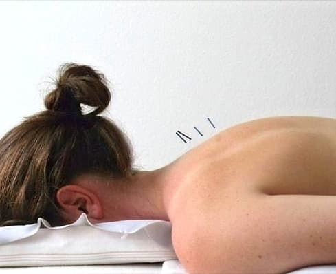 Praxis für Akupunktur und Massage Andrea Brunner — Massage in Zürich (Bild 3)