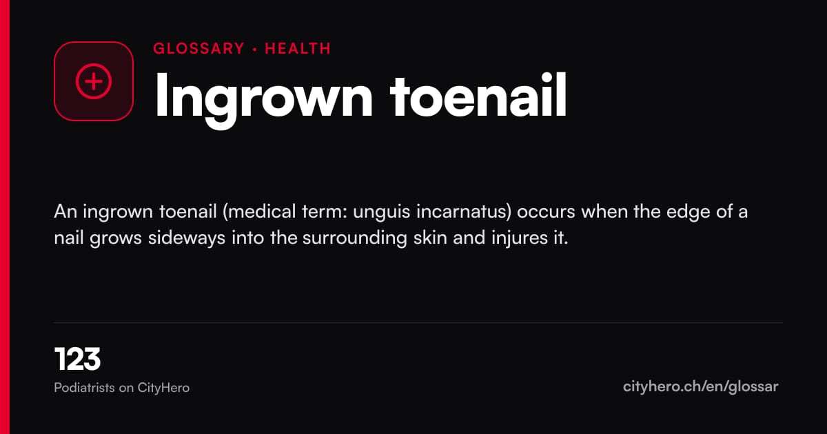 Ingrown toenail: Gesundheit – CityHero glossary graphic