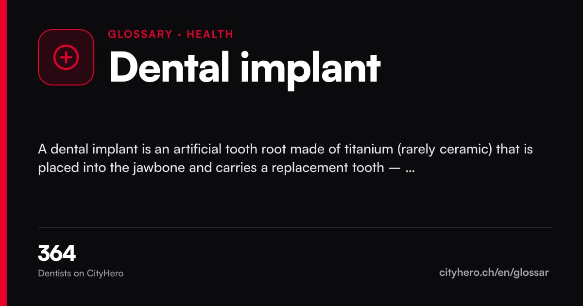Dental implant: Gesundheit – CityHero glossary graphic
